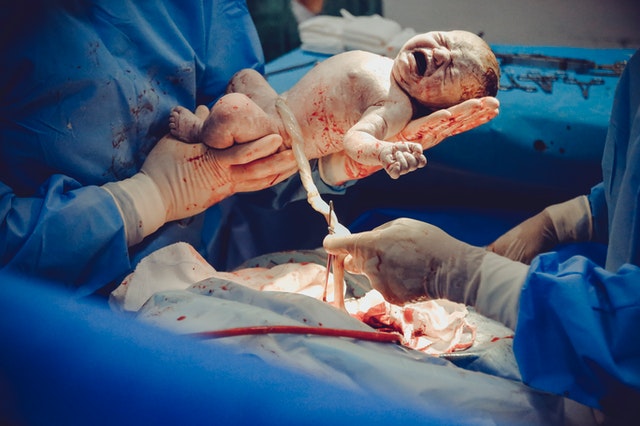 الولادة القيصرية: ماهي، ما أسبابها، وما هي آثارها؟